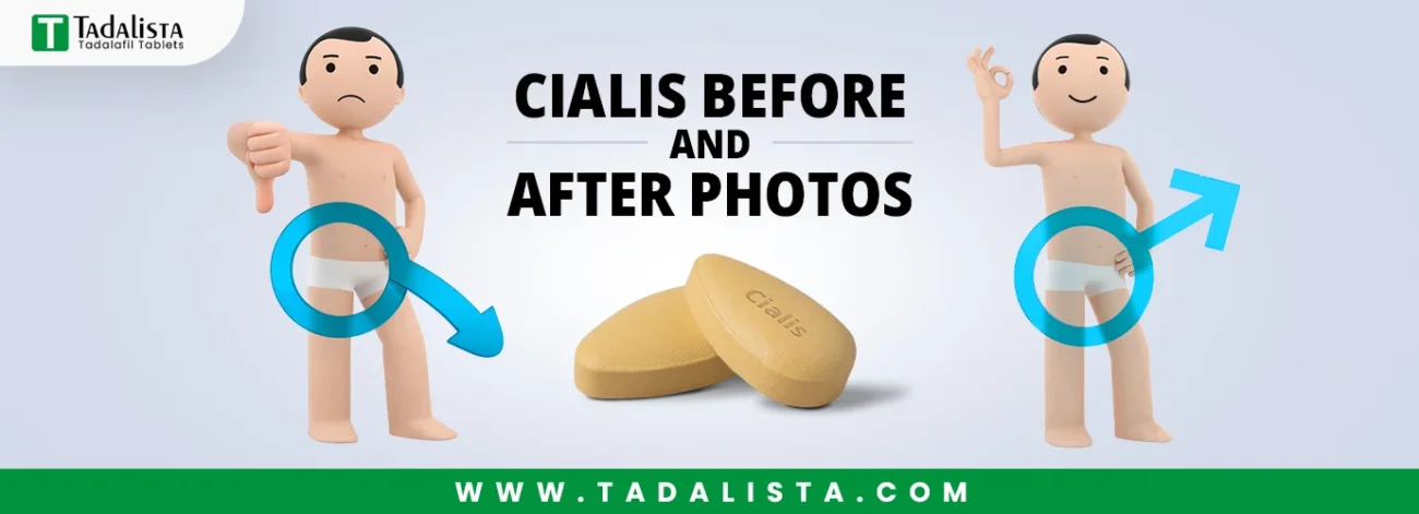 Cialis Before and After Photos