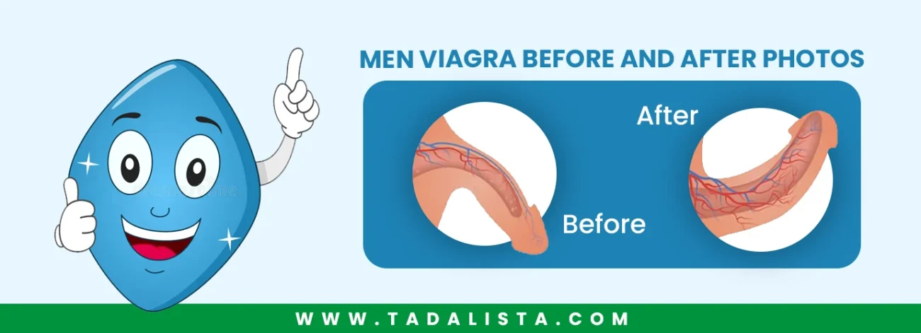 Men Viagra Before and After Photos