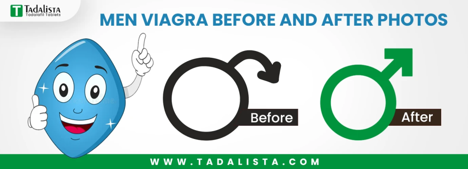Men Viagra Before and After Photos