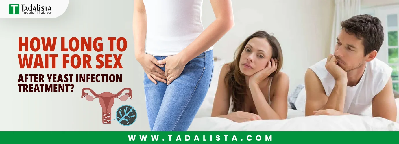 How Long to Wait for Sex After Yeast Infection Treatment