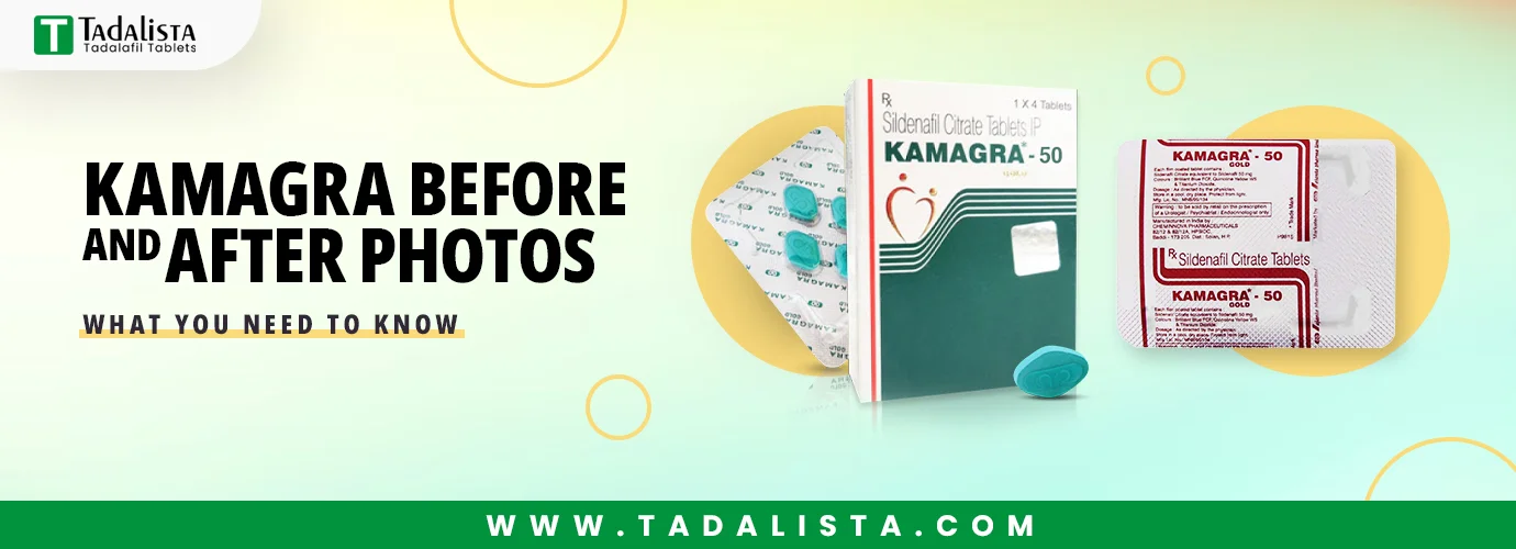 Kamagra Before and After Photos